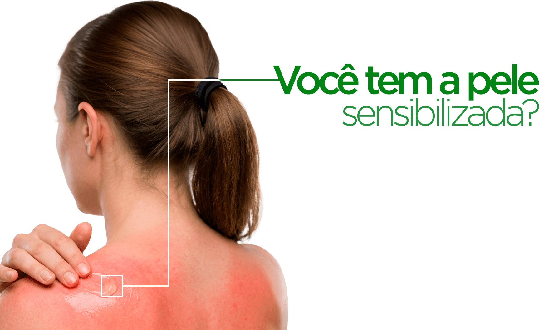 Pele sensibilizada